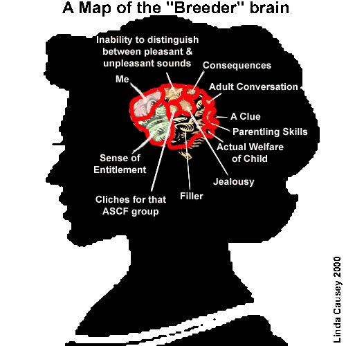 Breeder Brain