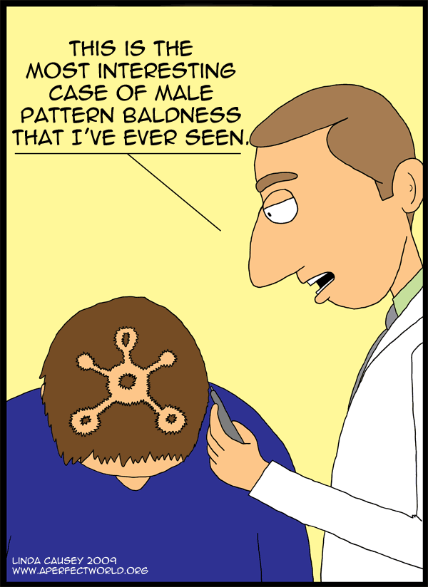 Unusual Male Pattern Baldness